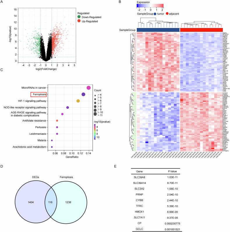 https://cdn.ncbi.nlm.nih.gov/pmc/blobs/b5ed/12056185/e82b2d9cd576/41419_2025_7692_Fig1_HTML.jpg