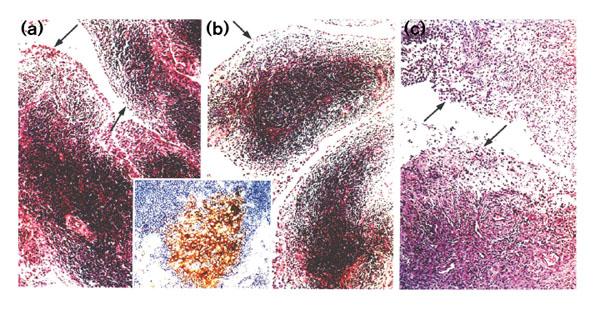 https://cdn.ncbi.nlm.nih.gov/pmc/blobs/b5f0/17813/4cefeed4c1b4/ar-2-4-303-3.jpg