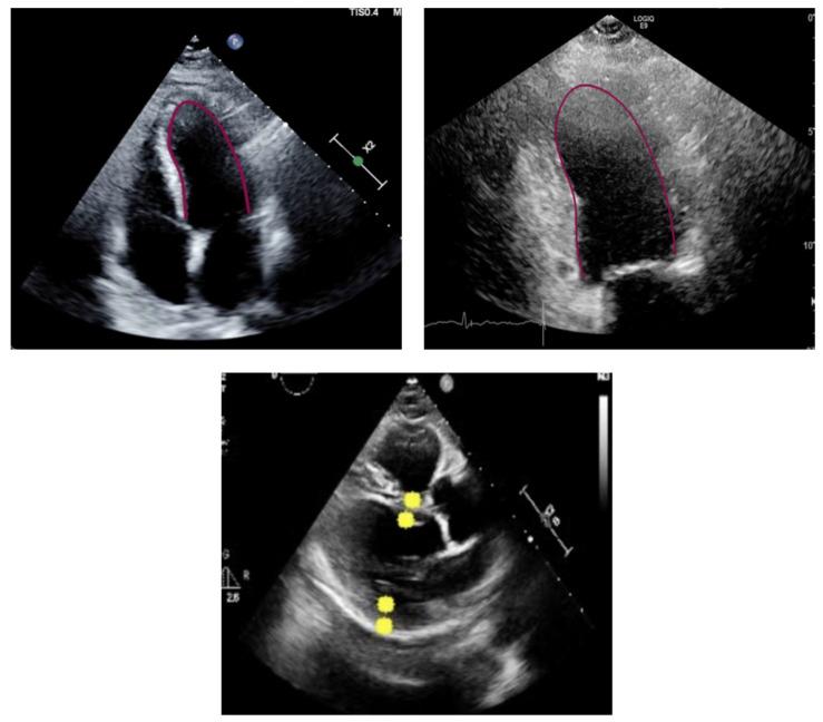 https://cdn.ncbi.nlm.nih.gov/pmc/blobs/b5fd/11353168/fee2b17924bc/diagnostics-14-01719-g001.jpg