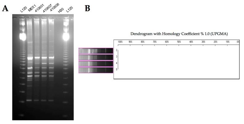 https://cdn.ncbi.nlm.nih.gov/pmc/blobs/b5fd/5713385/efeb0edfdf73/ijms-18-02417-g003.jpg