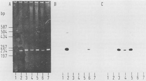 https://cdn.ncbi.nlm.nih.gov/pmc/blobs/b600/267121/3015c4056729/jcm00072-0147-a.jpg