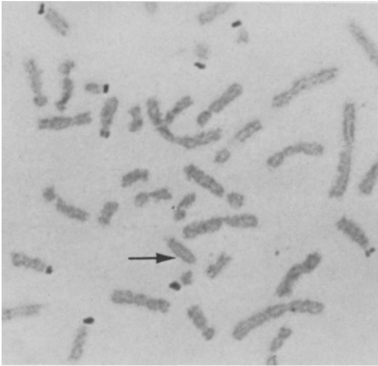 https://cdn.ncbi.nlm.nih.gov/pmc/blobs/b604/8997349/3516945c71de/599f02.jpg