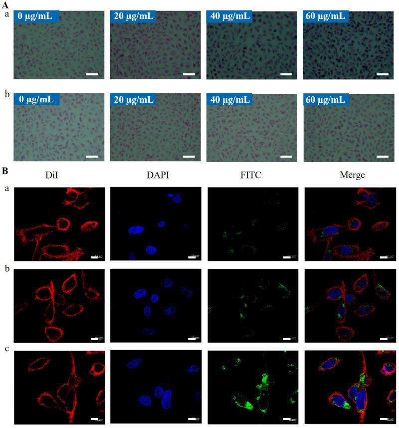 https://cdn.ncbi.nlm.nih.gov/pmc/blobs/b605/10785830/38f916fe0788/IJN-19-189-g0005.jpg