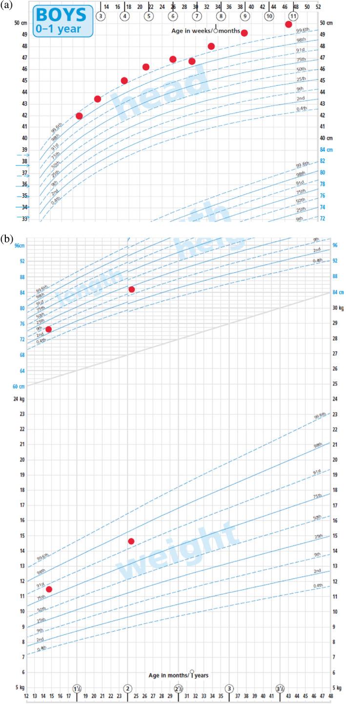 https://cdn.ncbi.nlm.nih.gov/pmc/blobs/b605/9310769/a47693dbfff7/AJMG-188-1896-g002.jpg