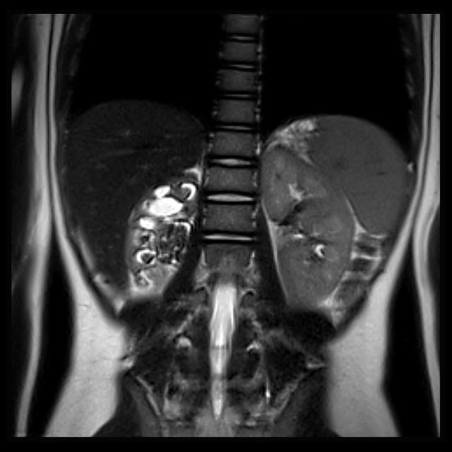 https://cdn.ncbi.nlm.nih.gov/pmc/blobs/b606/5637626/7297d55f4106/amjcaserep-18-1066-g003.jpg