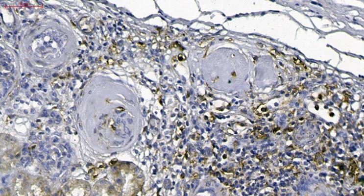 https://cdn.ncbi.nlm.nih.gov/pmc/blobs/b606/5637626/aa0f3d12939c/amjcaserep-18-1066-g006.jpg