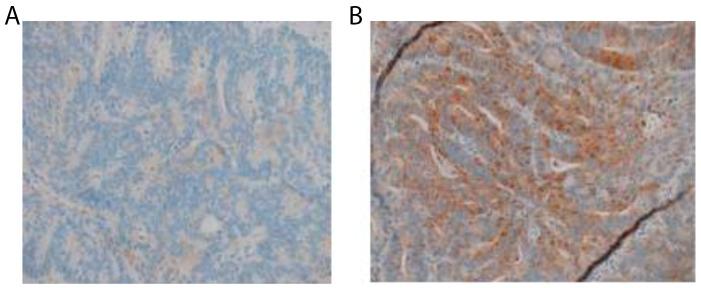 https://cdn.ncbi.nlm.nih.gov/pmc/blobs/b608/5844723/52add95ee743/oncotarget-09-11989-g008.jpg