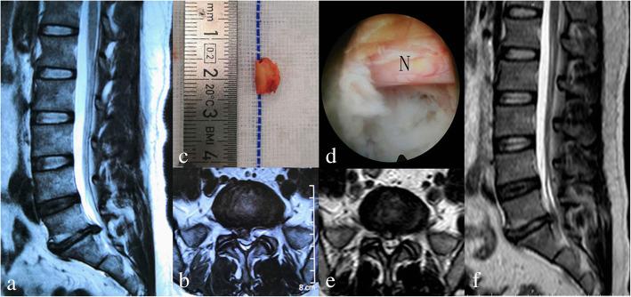 https://cdn.ncbi.nlm.nih.gov/pmc/blobs/b608/8218444/cbfb67d2d96d/13018_2021_2533_Fig4_HTML.jpg