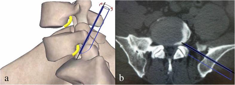https://cdn.ncbi.nlm.nih.gov/pmc/blobs/b608/8218444/ea085f32b502/13018_2021_2533_Fig2_HTML.jpg