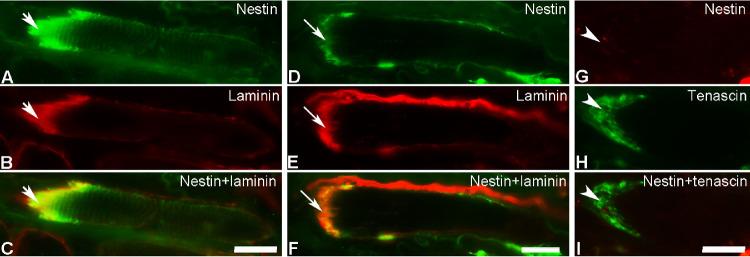 https://cdn.ncbi.nlm.nih.gov/pmc/blobs/b60b/7900863/635b941c8e5a/iovs-62-2-19-f004.jpg