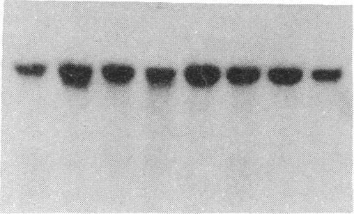 https://cdn.ncbi.nlm.nih.gov/pmc/blobs/b60c/387082/0018cf4aa972/pnas00327-0291-c.jpg