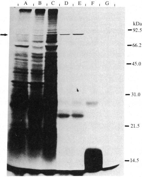 https://cdn.ncbi.nlm.nih.gov/pmc/blobs/b60c/387082/e9d2e9f14a6f/pnas00327-0290-b.jpg
