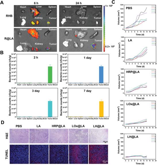 https://cdn.ncbi.nlm.nih.gov/pmc/blobs/b61d/12021032/941a0ecda181/ADVS-12-2417172-g002.jpg