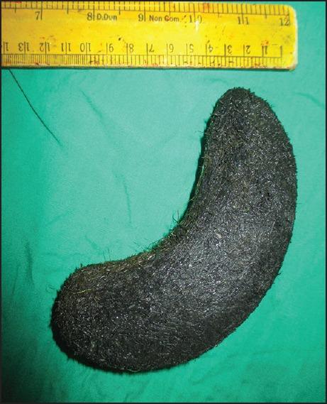 https://cdn.ncbi.nlm.nih.gov/pmc/blobs/b620/5009858/619ee2ae749b/JOACP-32-400-g001.jpg