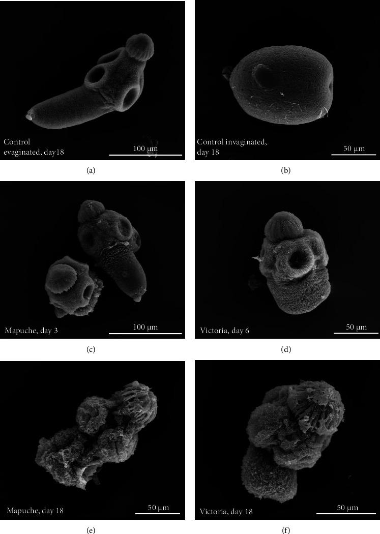 https://cdn.ncbi.nlm.nih.gov/pmc/blobs/b62b/11008976/22cc64380e05/ECAM2024-6251666.003.jpg
