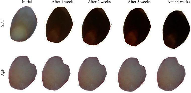 https://cdn.ncbi.nlm.nih.gov/pmc/blobs/b63a/9042602/c2007a8978e7/IJD2022-9483589.006.jpg