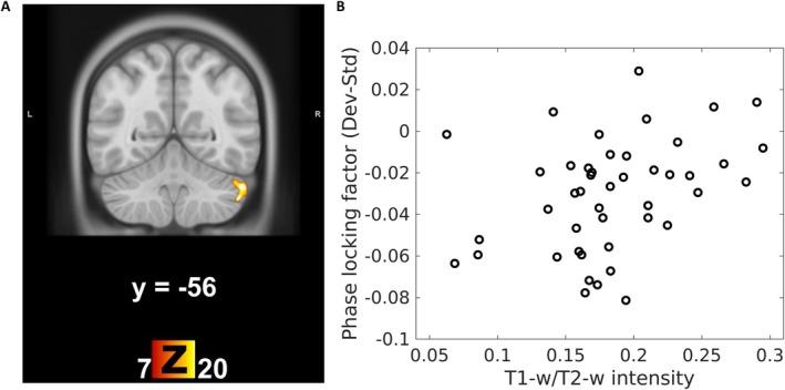 https://cdn.ncbi.nlm.nih.gov/pmc/blobs/b63e/11962760/8e038e26afeb/HBM-46-e70178-g001.jpg