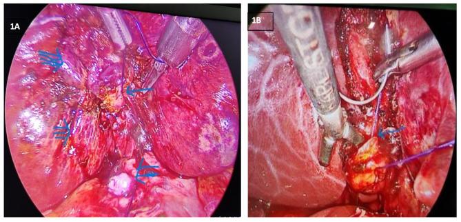 https://cdn.ncbi.nlm.nih.gov/pmc/blobs/b644/12001590/43f299bc5d62/12876_2025_3864_Fig1_HTML.jpg