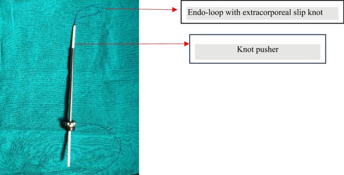 https://cdn.ncbi.nlm.nih.gov/pmc/blobs/b644/12001590/6480ad0e4b14/12876_2025_3864_Fig2_HTML.jpg