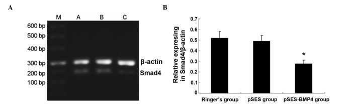 https://cdn.ncbi.nlm.nih.gov/pmc/blobs/b64a/4068724/70b459587186/MMR-10-01-0033-g02.jpg