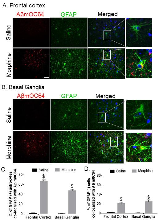 https://cdn.ncbi.nlm.nih.gov/pmc/blobs/b650/8407877/0c4440c0001e/ad-12-6-1389-g2.jpg
