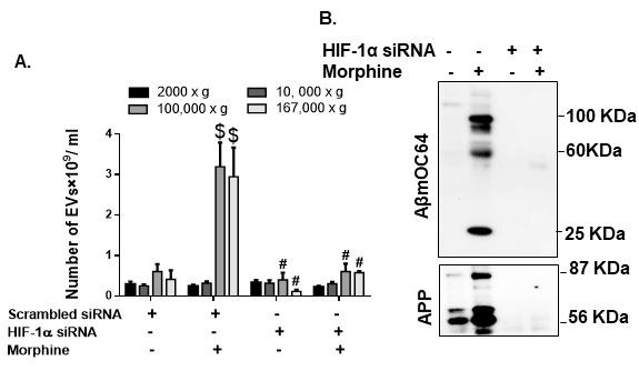 https://cdn.ncbi.nlm.nih.gov/pmc/blobs/b650/8407877/755c44f126b9/ad-12-6-1389-g9.jpg