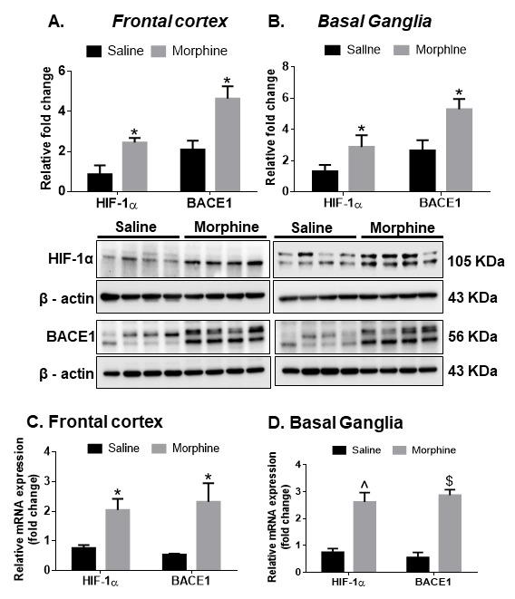 https://cdn.ncbi.nlm.nih.gov/pmc/blobs/b650/8407877/808bdebf2218/ad-12-6-1389-g7.jpg
