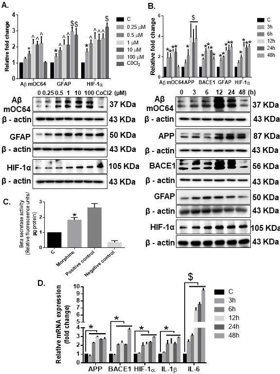 https://cdn.ncbi.nlm.nih.gov/pmc/blobs/b650/8407877/8336fdee3827/ad-12-6-1389-g4.jpg