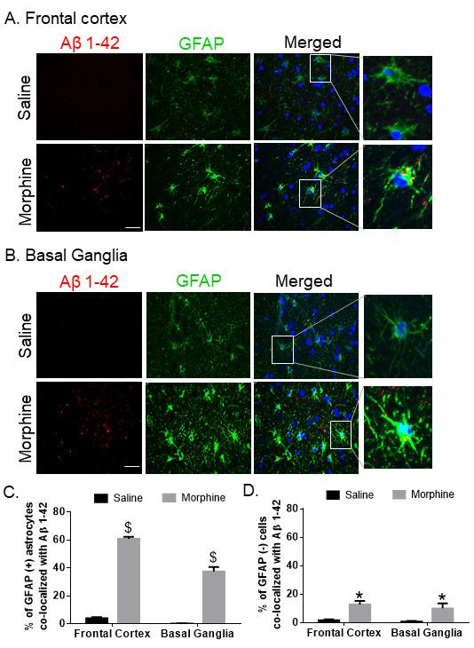 https://cdn.ncbi.nlm.nih.gov/pmc/blobs/b650/8407877/c8249b2923eb/ad-12-6-1389-g3.jpg