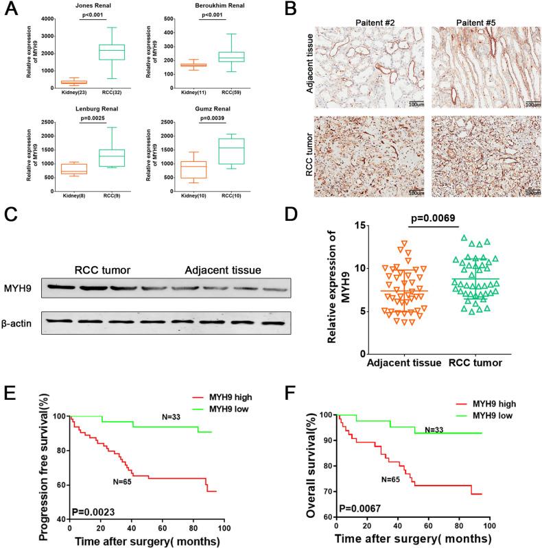 https://cdn.ncbi.nlm.nih.gov/pmc/blobs/b65f/8941107/ce62f92013b3/41420_2022_933_Fig2_HTML.jpg