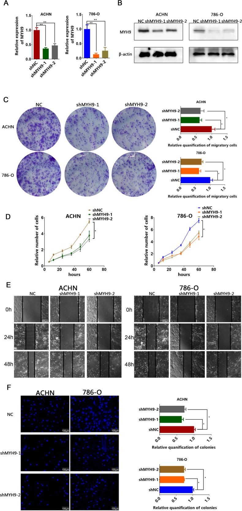 https://cdn.ncbi.nlm.nih.gov/pmc/blobs/b65f/8941107/ff8d5fd1ff94/41420_2022_933_Fig3_HTML.jpg