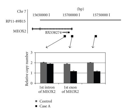 https://cdn.ncbi.nlm.nih.gov/pmc/blobs/b660/3010704/a15bdb71edb8/JBB2011-820472.003.jpg