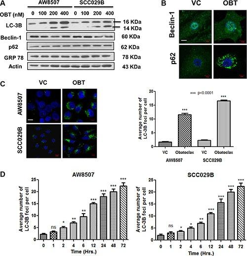 https://cdn.ncbi.nlm.nih.gov/pmc/blobs/b660/5601122/75ec66c7a712/oncotarget-08-60060-g003.jpg