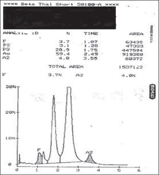 https://cdn.ncbi.nlm.nih.gov/pmc/blobs/b662/4782486/246a15ad129e/AJTS-10-105-g004.jpg