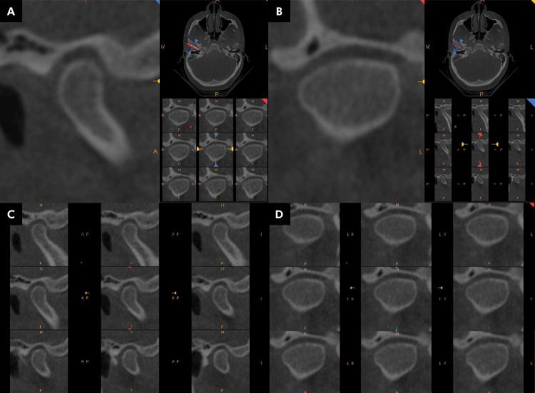 https://cdn.ncbi.nlm.nih.gov/pmc/blobs/b668/11376684/2f63b470c242/1807-3107-bor-38-e060-gf02.jpg
