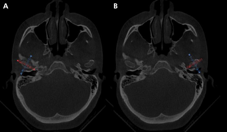 https://cdn.ncbi.nlm.nih.gov/pmc/blobs/b668/11376684/9ca644599091/1807-3107-bor-38-e060-gf01.jpg