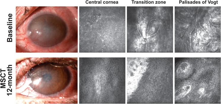 https://cdn.ncbi.nlm.nih.gov/pmc/blobs/b66d/10640524/6b9072414c6f/40123_2023_809_Fig3_HTML.jpg