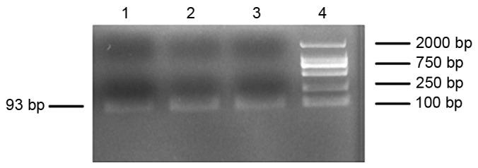 https://cdn.ncbi.nlm.nih.gov/pmc/blobs/b671/5658692/66665f826e08/etm-14-05-4065-g01.jpg