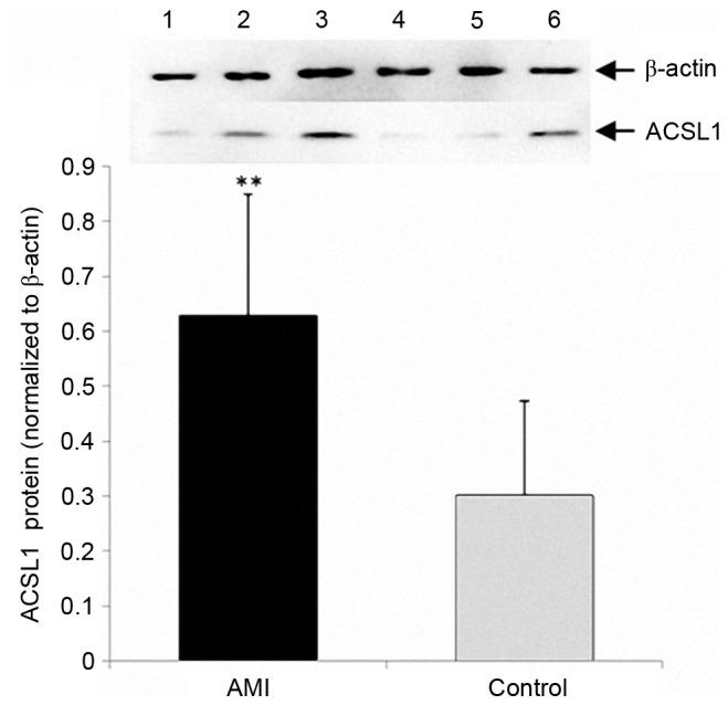 https://cdn.ncbi.nlm.nih.gov/pmc/blobs/b671/5658692/be08352ff141/etm-14-05-4065-g03.jpg