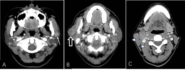 https://cdn.ncbi.nlm.nih.gov/pmc/blobs/b672/7988088/f53f5a5bcbe4/fonc-11-634452-g003.jpg
