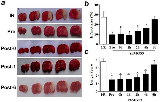 https://cdn.ncbi.nlm.nih.gov/pmc/blobs/b676/5008374/013a3b3007c1/oncotarget-07-22474-g003.jpg