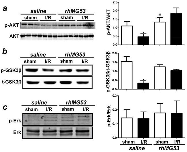 https://cdn.ncbi.nlm.nih.gov/pmc/blobs/b676/5008374/5b99d92d5dd1/oncotarget-07-22474-g006.jpg