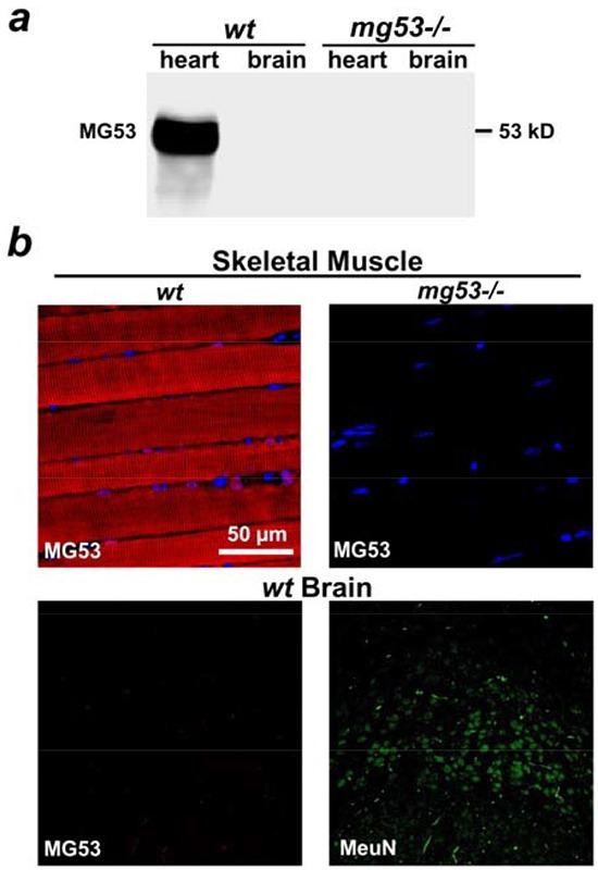 https://cdn.ncbi.nlm.nih.gov/pmc/blobs/b676/5008374/a4ff675eda55/oncotarget-07-22474-g001.jpg