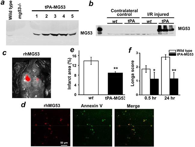 https://cdn.ncbi.nlm.nih.gov/pmc/blobs/b676/5008374/cef7db7ffc82/oncotarget-07-22474-g005.jpg