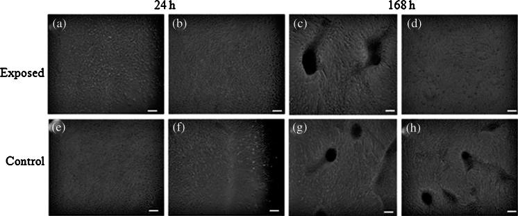 https://cdn.ncbi.nlm.nih.gov/pmc/blobs/b67a/4062816/ce62e768cb65/11626_2013_9730_Fig8_HTML.jpg