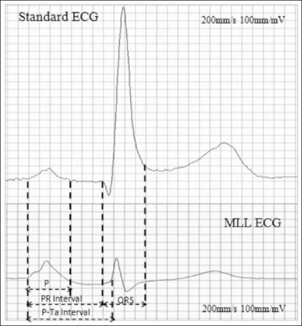 https://cdn.ncbi.nlm.nih.gov/pmc/blobs/b67c/5336858/48cc64b73c1c/AJC-15-605-g004.jpg