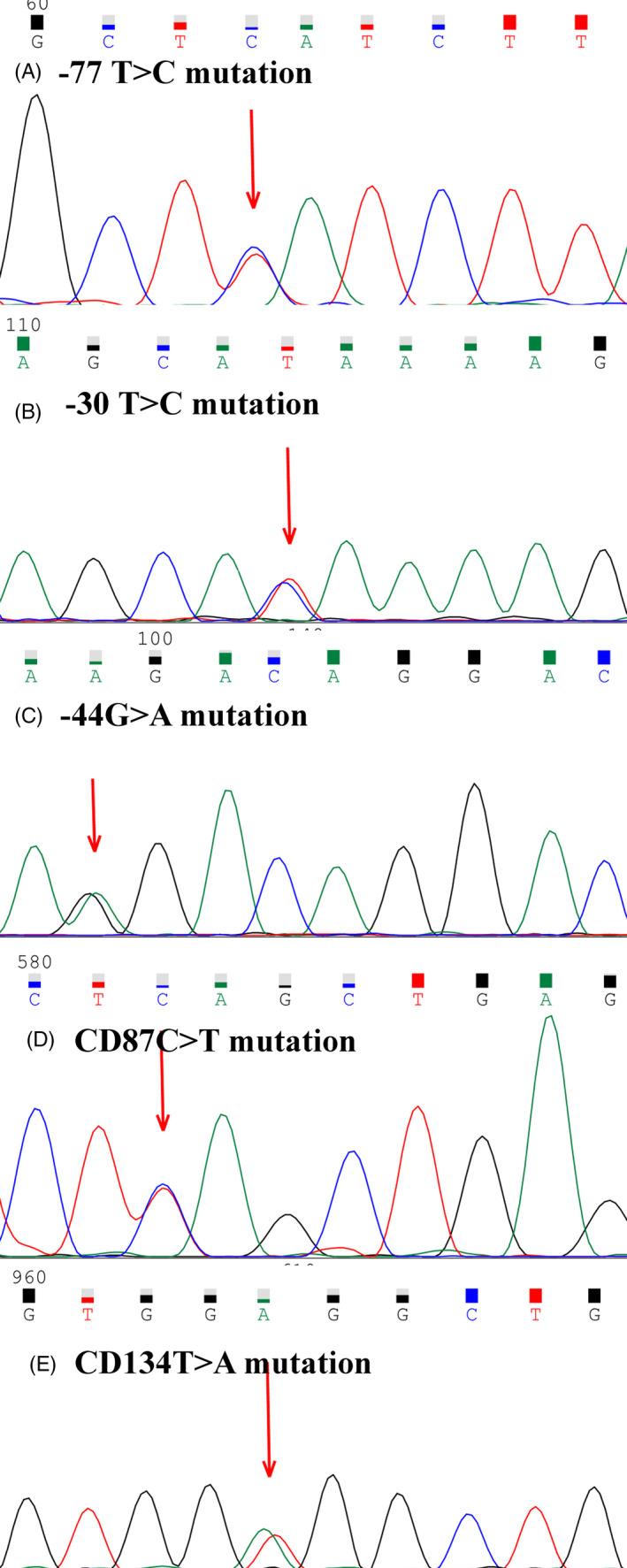 https://cdn.ncbi.nlm.nih.gov/pmc/blobs/b680/7676206/ac08648735b0/JCLA-34-e23479-g001.jpg