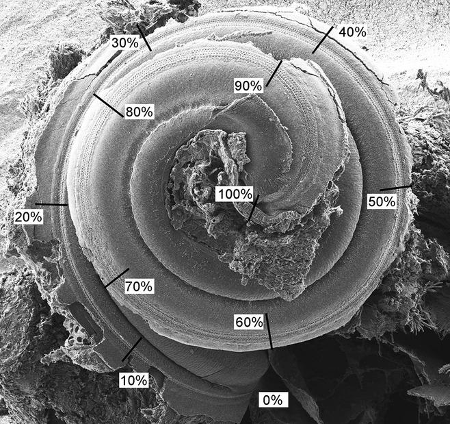 https://cdn.ncbi.nlm.nih.gov/pmc/blobs/b689/4065360/fc89b7db8c20/ejn0039-0744-f1.jpg