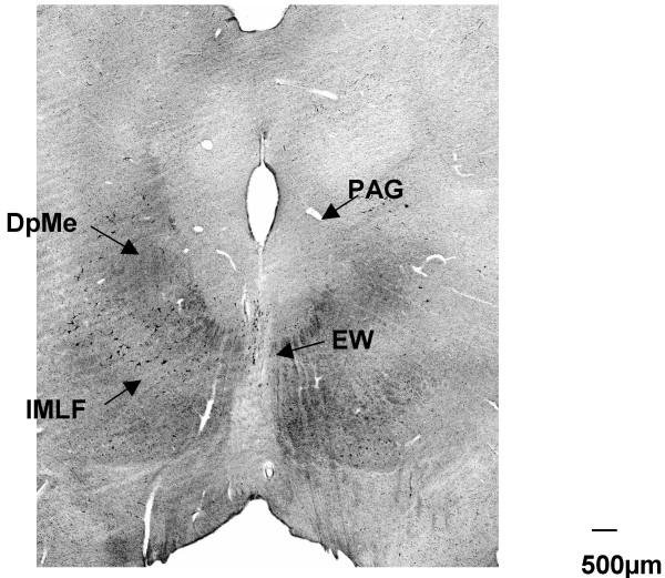 https://cdn.ncbi.nlm.nih.gov/pmc/blobs/b6a2/1919385/205fb47586af/1471-2202-8-40-10.jpg