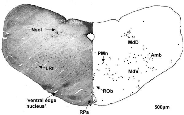 https://cdn.ncbi.nlm.nih.gov/pmc/blobs/b6a2/1919385/2817c73670c9/1471-2202-8-40-3.jpg